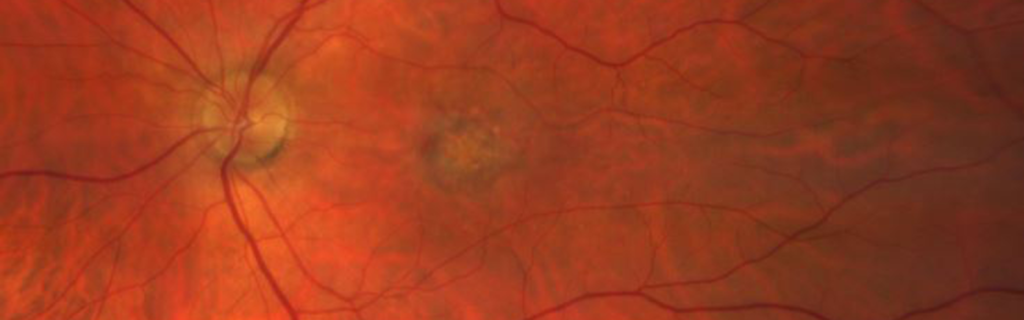 Fundus