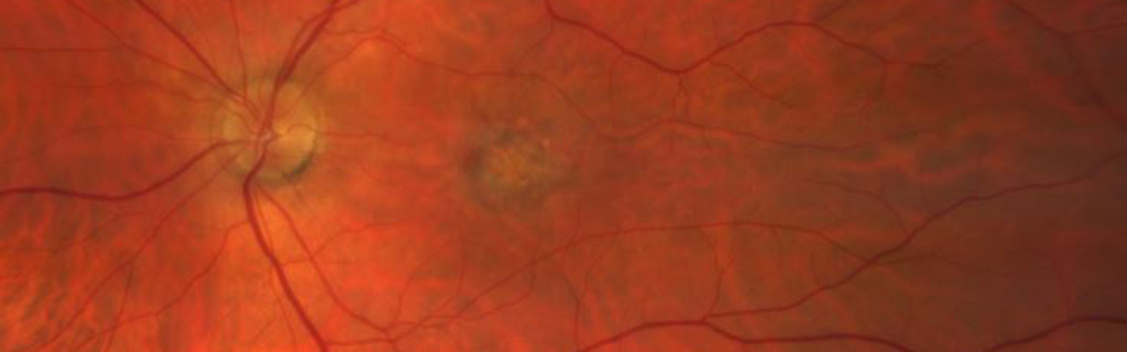 Ocular Banner
