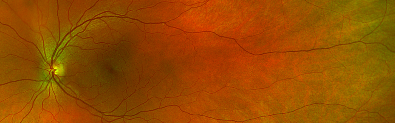 Image of fundus.